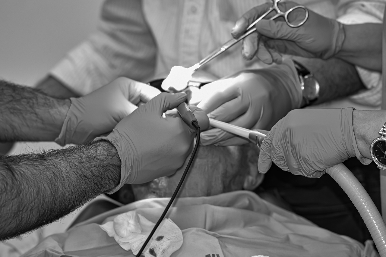 What You Should Know About Lymph Node Biopsy