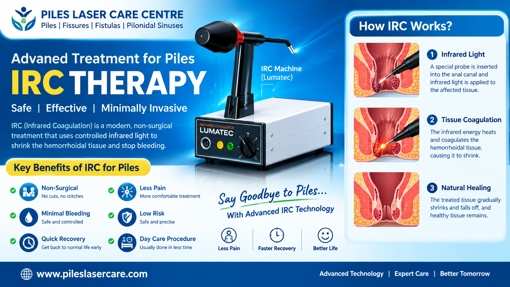 Everything About Piles: Cause, Types, Symptoms, Precautions & treatments- A Complete Factual Guide
