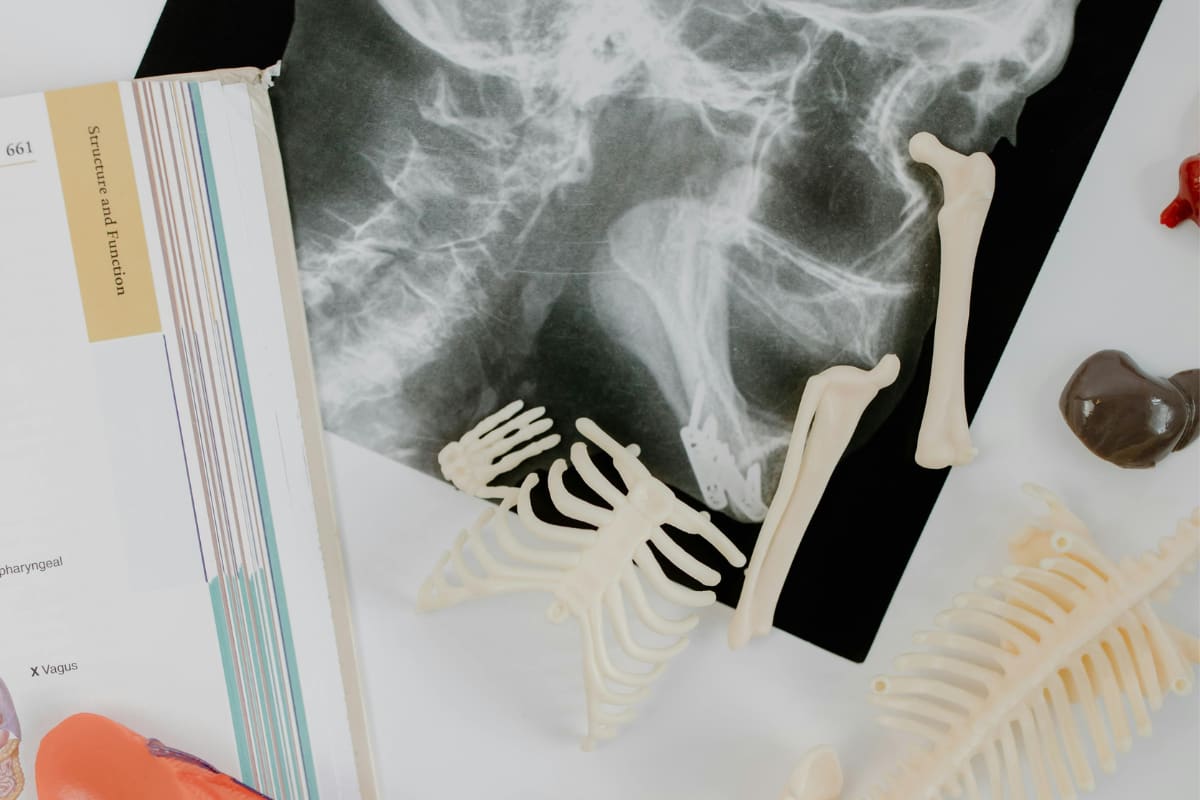 Orthopedic Range pharmaceutical products by Stellar Biolabs