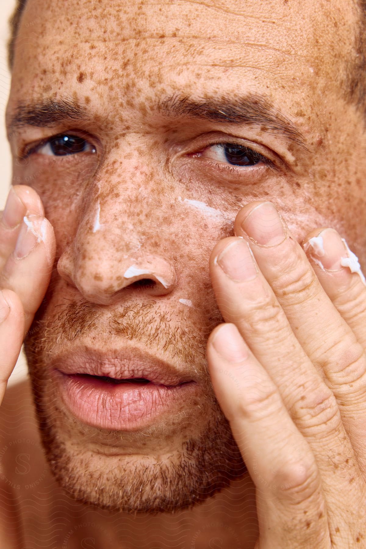 Man with facial hair and freckles applies face cream