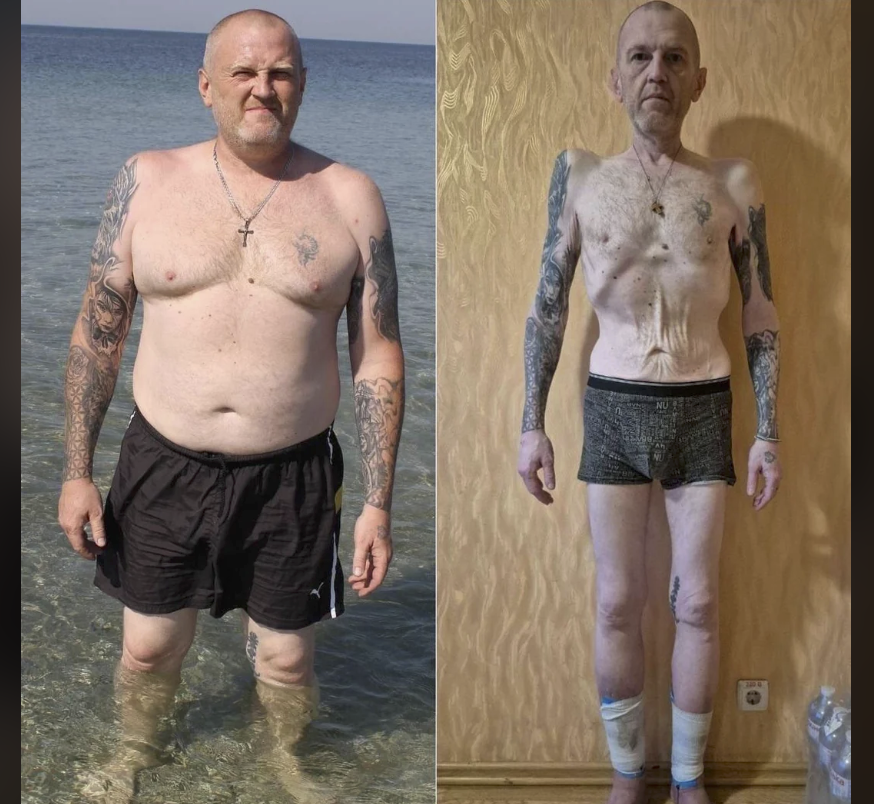 Ukrainian soldier Oleksandr Kiriyenko before and after release from Russian captivity