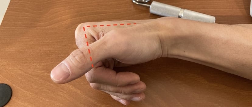 握拳動態的極限