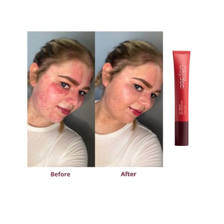 Vacatures bij Aspilon Cosmetics