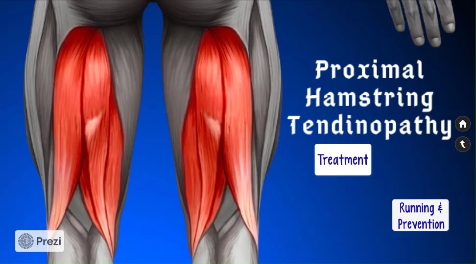 The 3 stages of PHT rehab