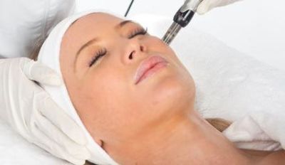 Skin Needling Skin Needling