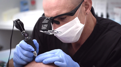 Scalp Micropigmentation Clinic Hair Tattoo Sydney Novoscalp