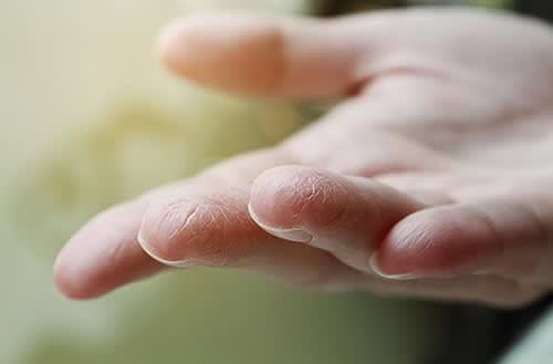 Kışın Kurumuş Parmaklar