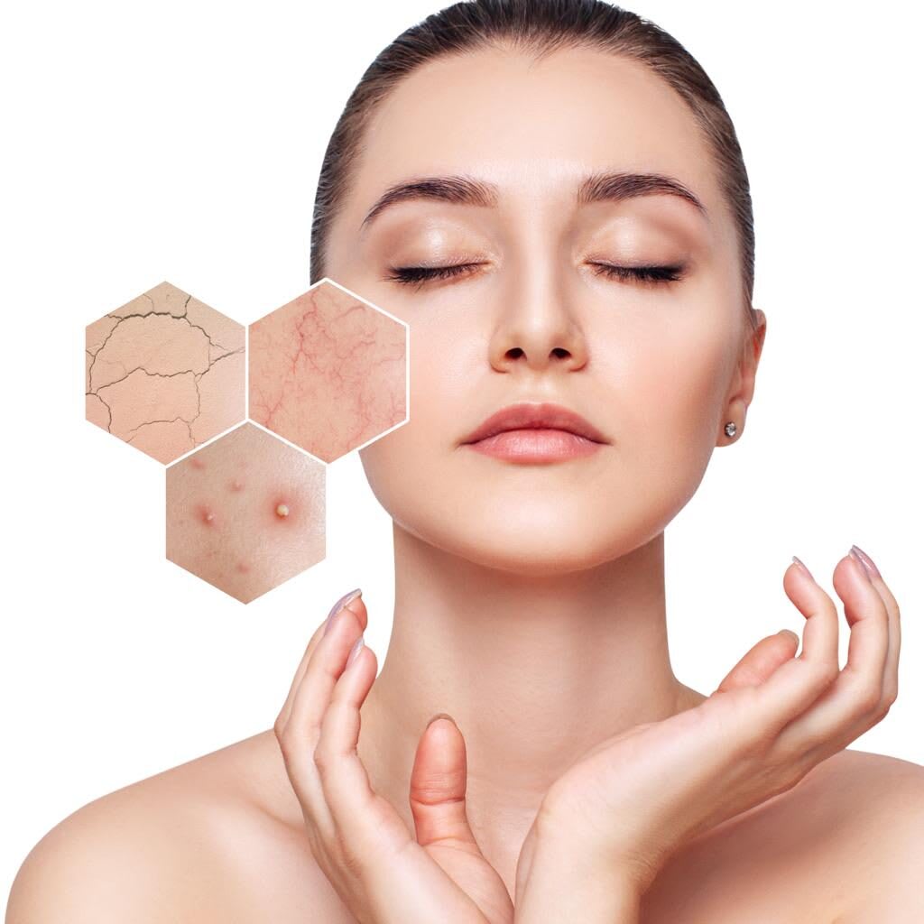 Akne Önleyici Ürünler