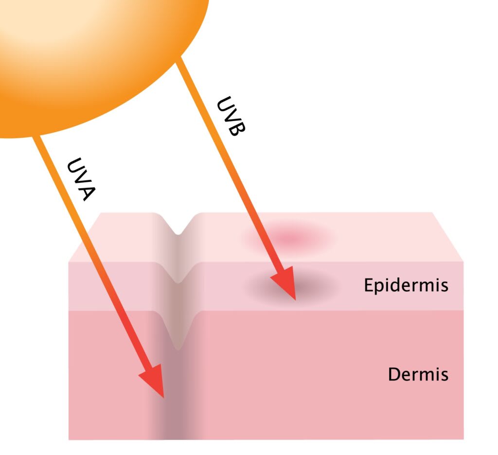Dermis Epidermis UVA UVB Işınları