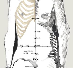 Andreas sciatica 2 jpeg