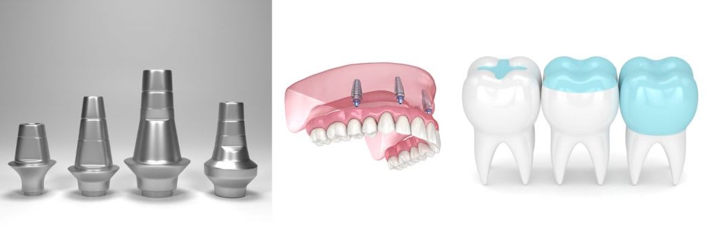Conclusion_dental_milling