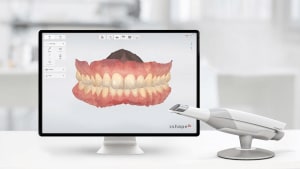 3shape-Trios-Intraoral-Scanner-300x169