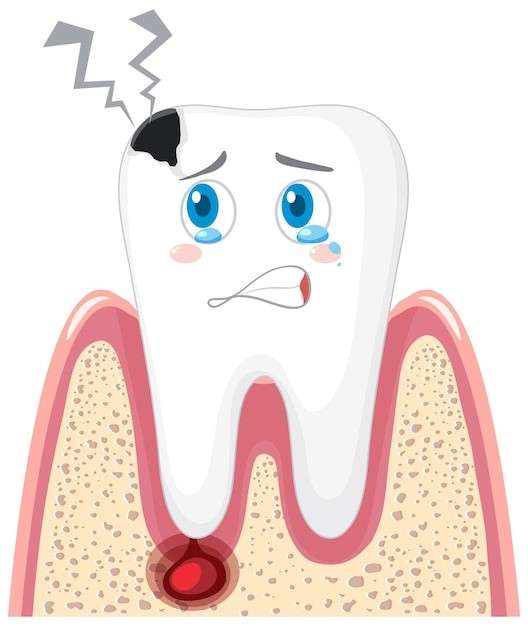 Prevention and Management of Dental Erosion Image 2