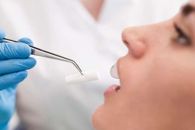 Prevention and Management of Dental Erosion Image 4