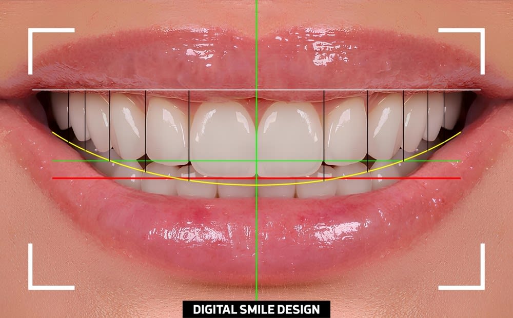 Digital Smile