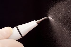 ultrasonic-scaling-300x200