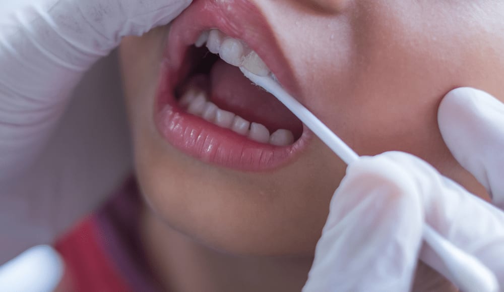 Managing and Preventing Dental Hypersensitivity