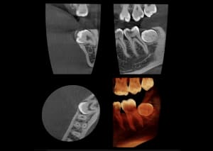 Dental-CBCT-Machine-2-300x213