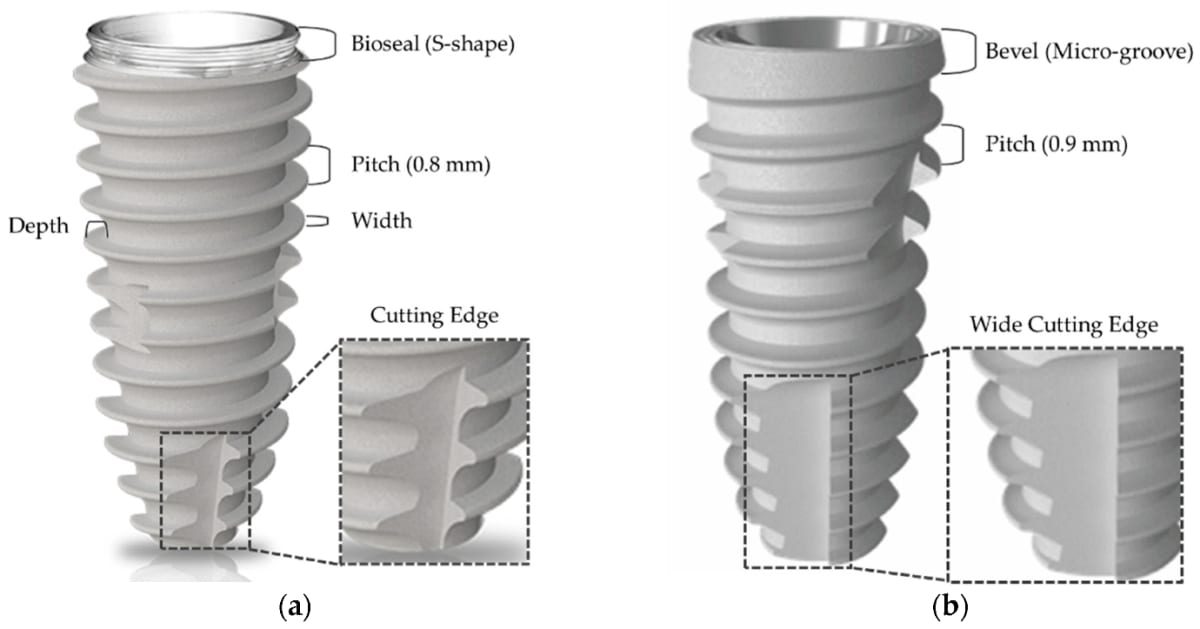 Digital Planning and Minimally Invasive Implant Surgery