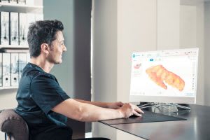 Dental-CAD-CAM-Systems-1-300x200