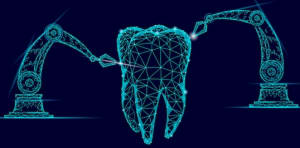 Robot-Assisted Implant Surgery