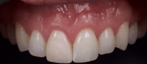 Biocompatible-Materials-3-233x300