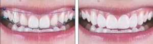 Trios-Smile-Design-300x86