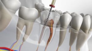 teeth