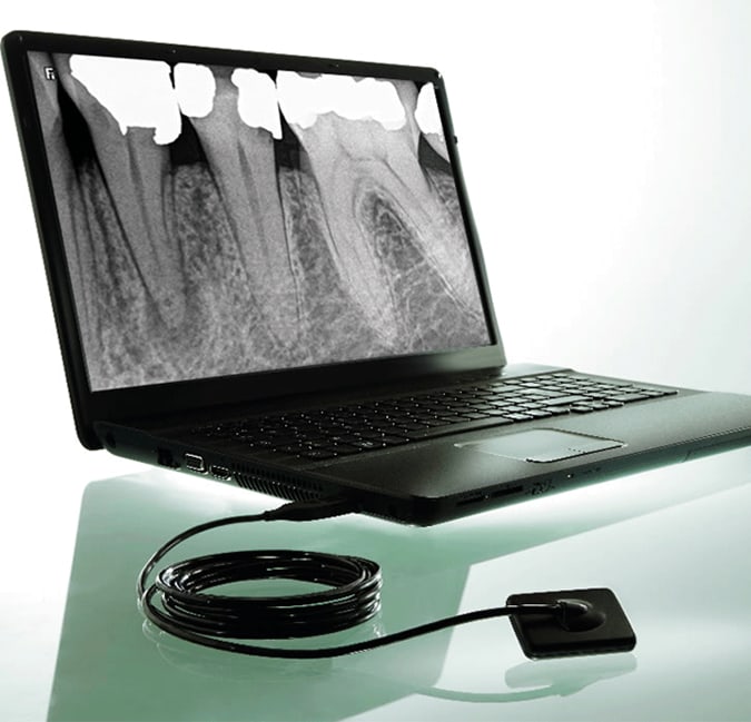 Carestream 5200 RVG - A Diagnostic Solution For Your Daily Dental Practice