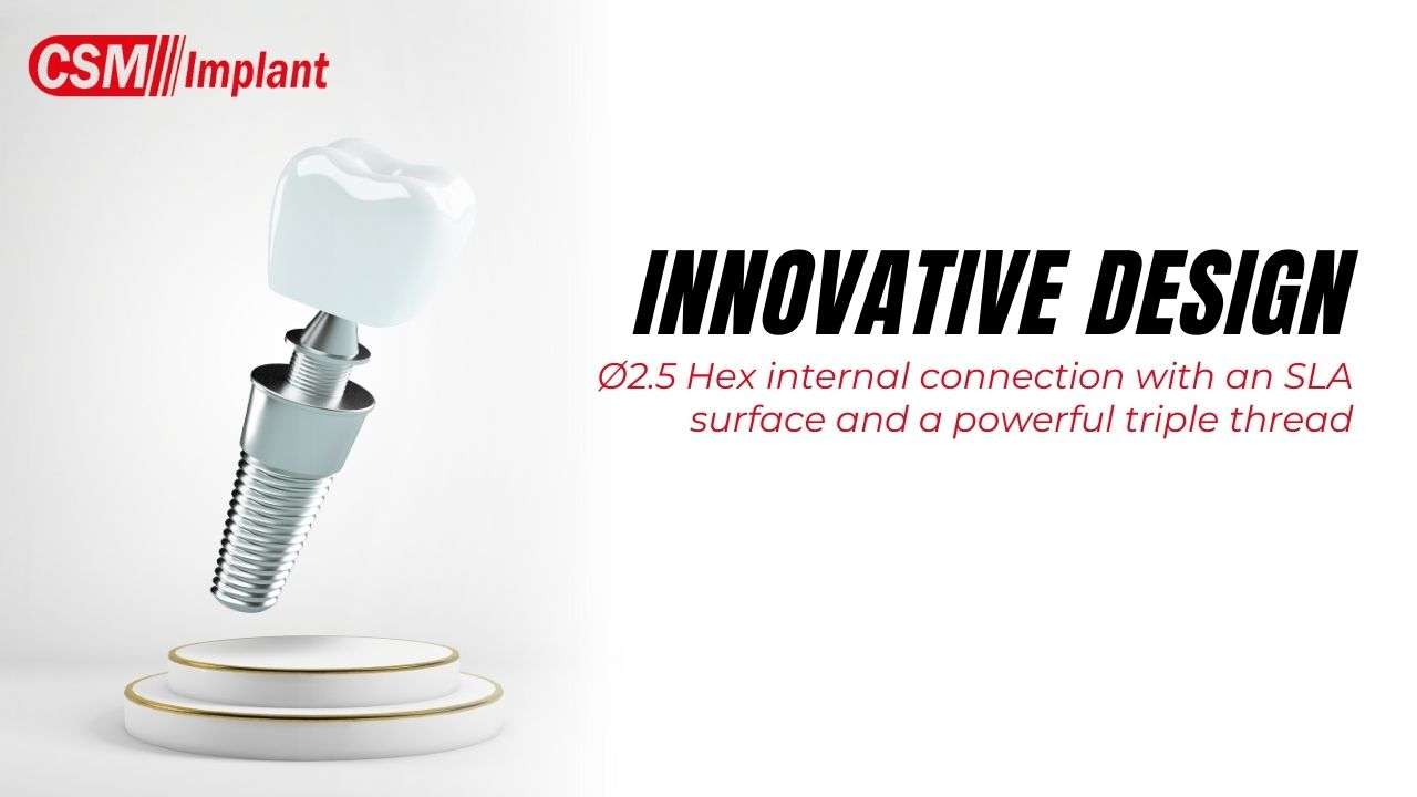 css-implants Key Featurs