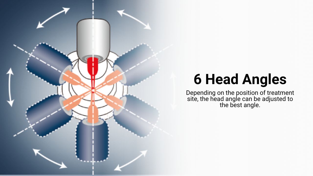 NSK Endomate DT Key Feature 3