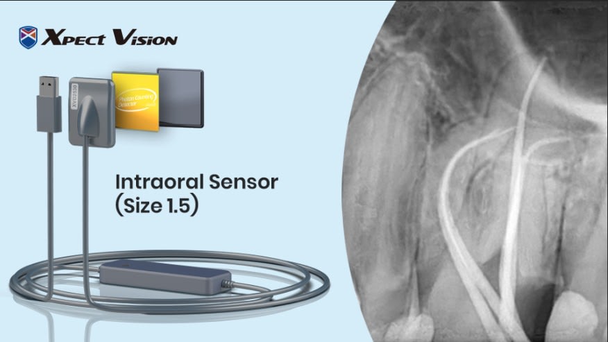 AI Powered Xpect Vision Digital Dental Imaging Sensor – Size 1.5