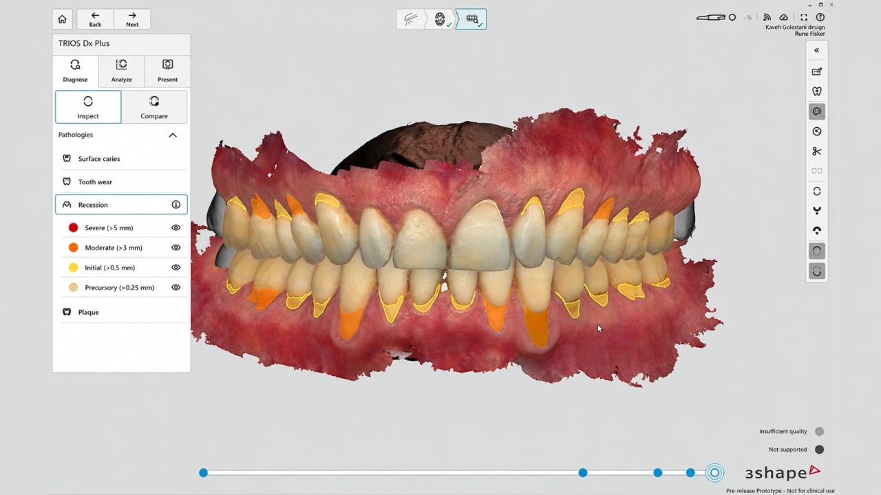 3Shape TRIOS 6 Intraoral Scanner — photo 8