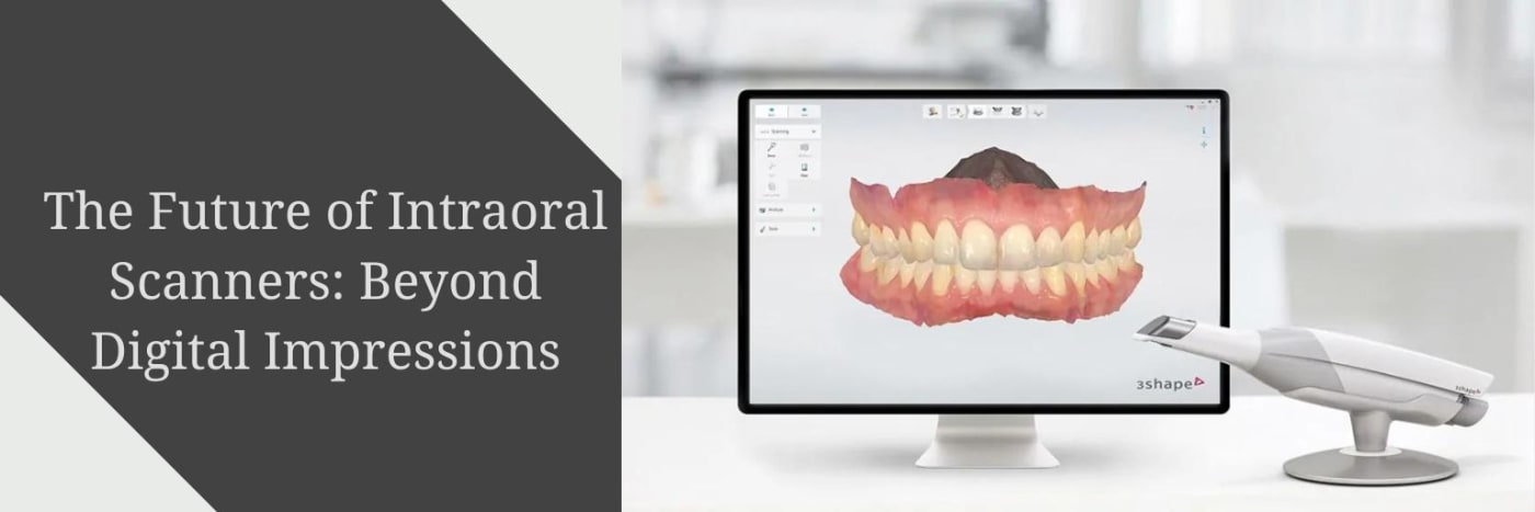 The Future of Intraoral Scanners: Beyond Digital Impressions