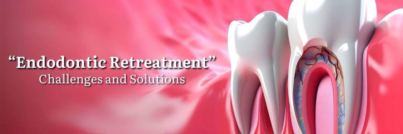 Endodontic Retreatment: Challenges and Solutions