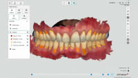 3Shape TRIOS 6 Intraoral Scanner — photo 8