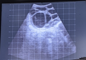 Interesting Ovaries