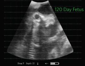 Tips, Tricks and Techniques – Fetal Aging: Plan Ahead for Success!