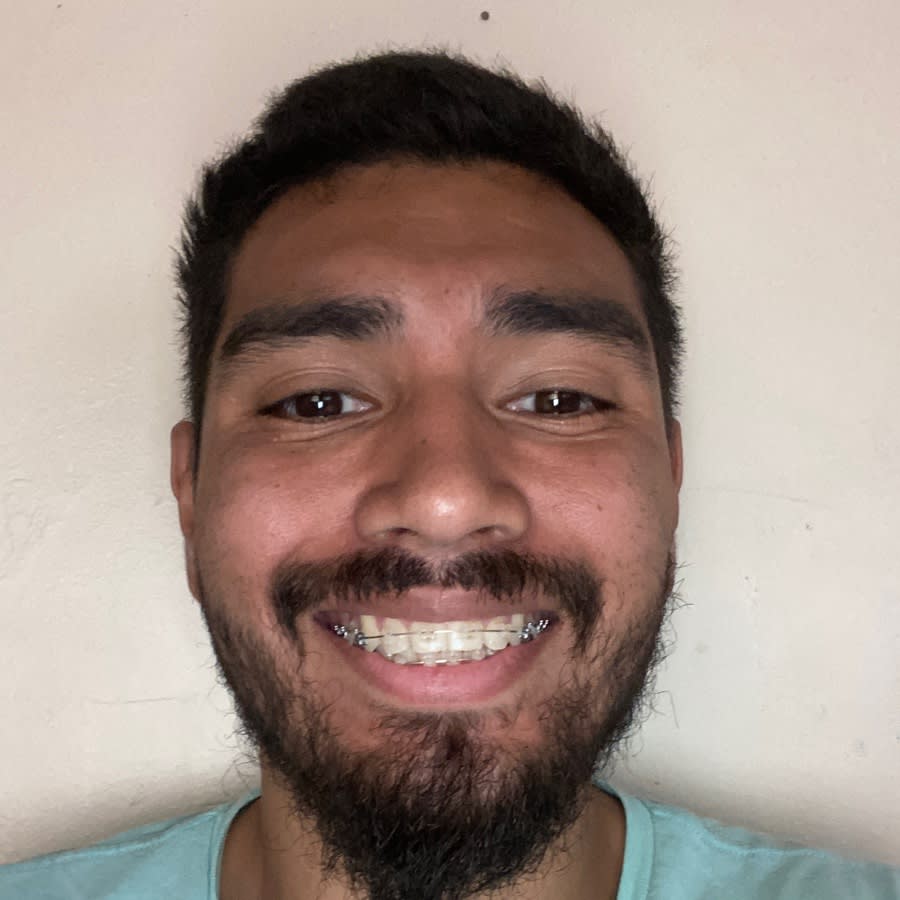 Image thumbnail of a tasker