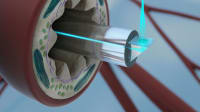 Related article image