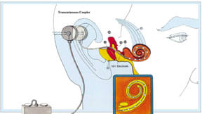Feature Image
