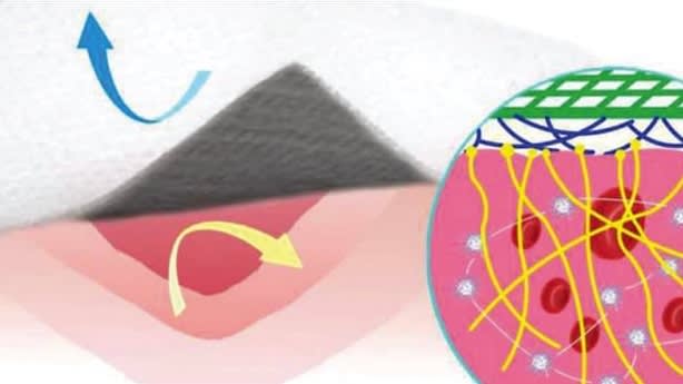 Squirtable Surgical Glue Could Transform Surgeries and Save Lives - Medical  Design Briefs