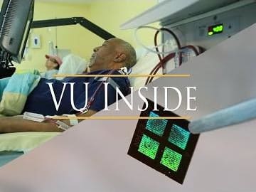 Feature Image