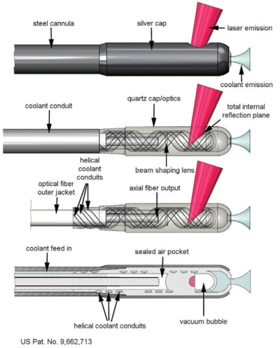Fibre optic laser deals