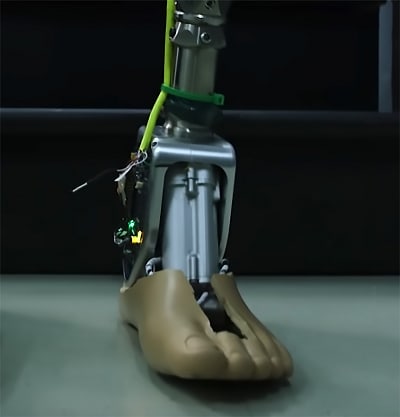 Smart' Prosthetic Ankle Takes Fear Out of Tough Terrain - Medical