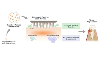 Image 3 for Scientists create dissolvable microneedle patch for heart tissue repair