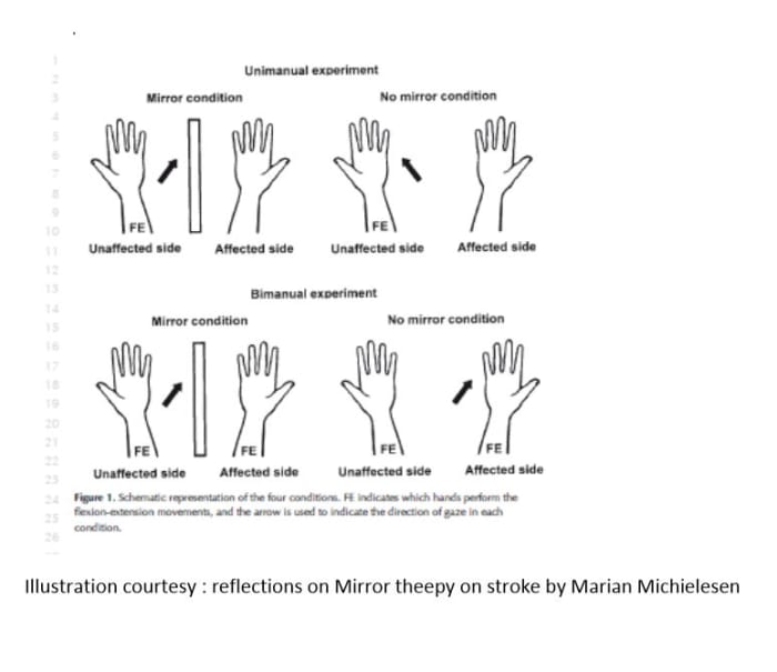 mirror therapy for stroke rehabilitation through image processing