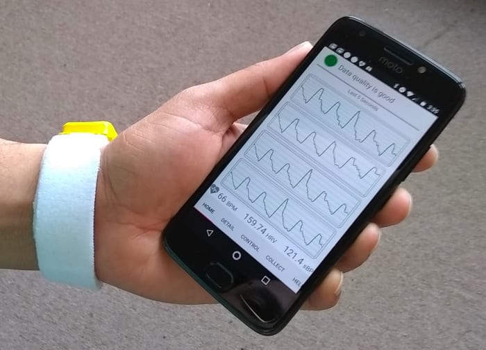 Continuous Wearable Blood Pressure Monitor