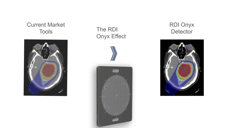 Scan Rdi Results RDI Onyx - Better Imaging, Better Results - Create the Future