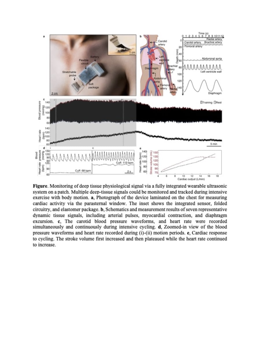 A Wireless Wearable Ultrasound Patch for Deep Tissue Monitoring
